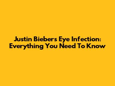 Justin Bieber's Eye Infection: Everything You Need To Know