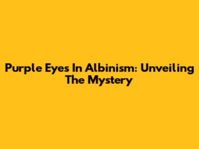 Purple Eyes In Albinism: Unveiling The Mystery