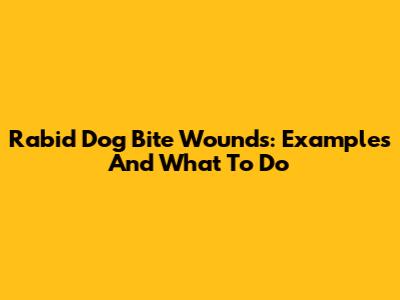 Rabid Dog Bite Wounds: Examples And What To Do