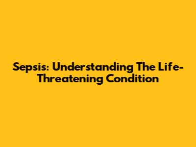 Sepsis: Understanding The Life-Threatening Condition
