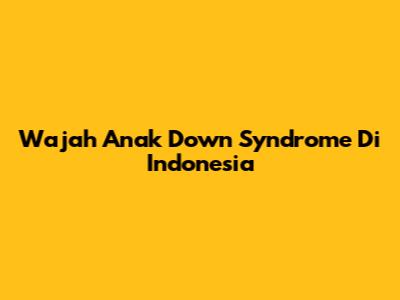 Wajah Anak Down Syndrome Di Indonesia